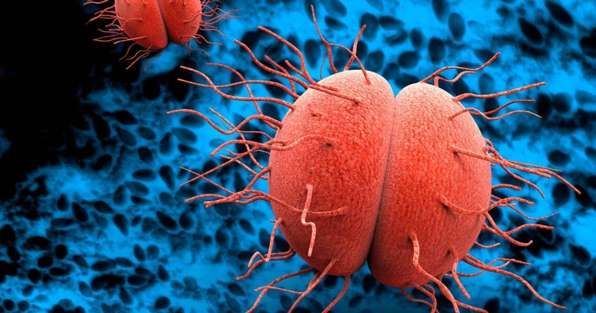 What Is Gonorrhea?