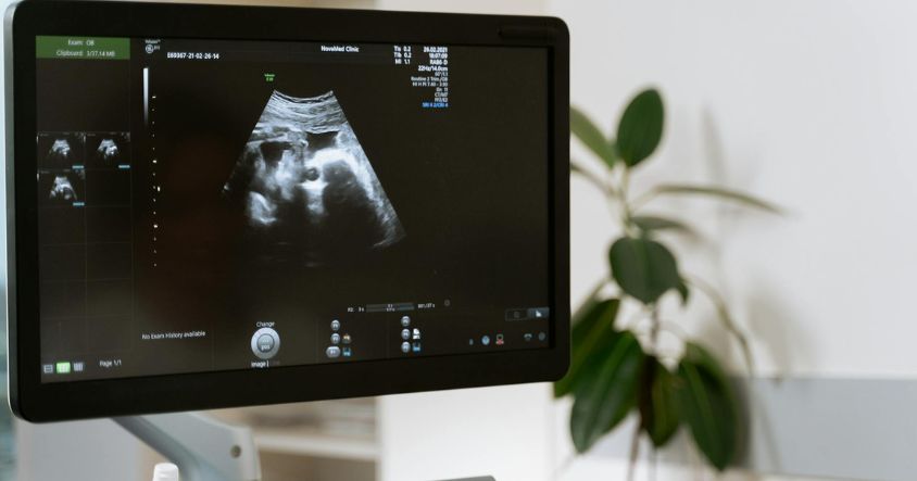 This article explores ultrasound accessories you may not realise you need, and explains how they improve image accuracy and patient safety.