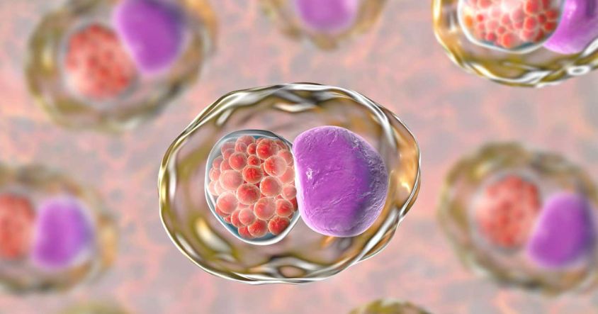 Chlamydia in Zimbabwe is caused by a bacterium called Chlamydia trachomatis and often spreads silently as many people have no symptoms.